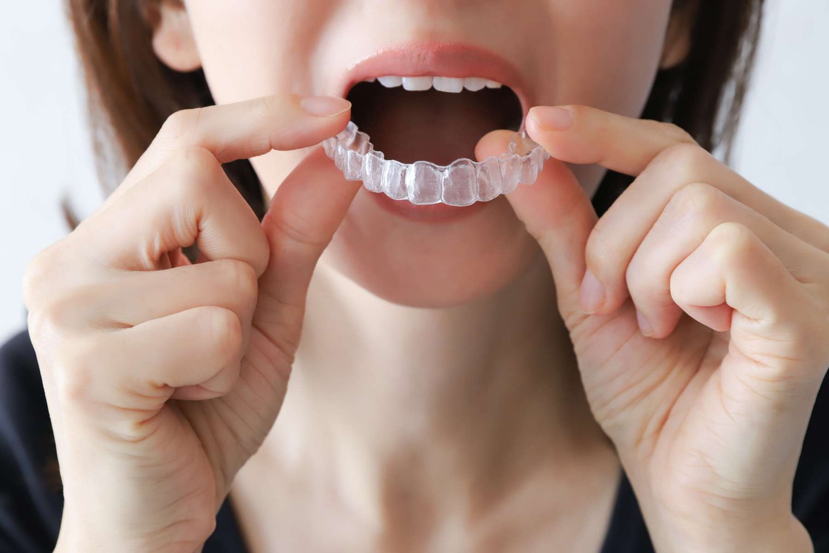 Alinhadores invisíveis