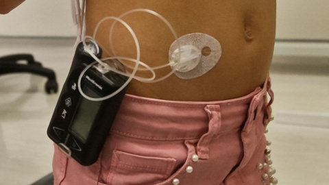 Foto&nbsp;José Carmo / Global Imagens