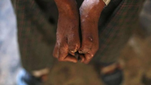 FOTO Reuters