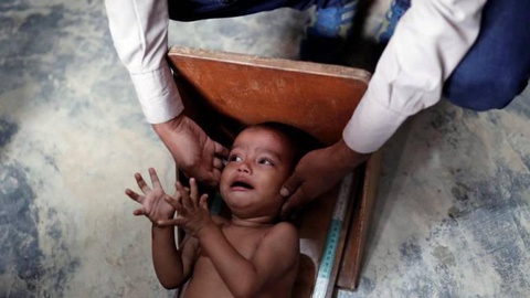 Uma vítima da fome no Ruanda.  Foto REUTERS/Tyrone Siu