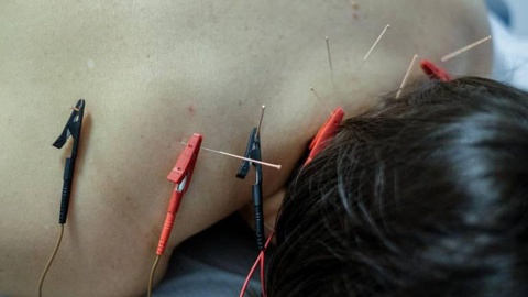 foto FocusCelebration/Global Imagens