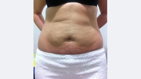 Antes
