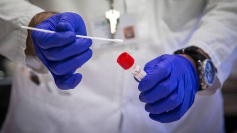 Foto  EPA/ANDREA FASANI