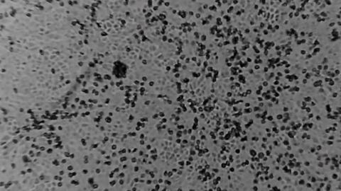 Foto EPA/Instituto PETER DOHERTY