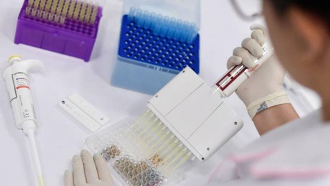 Foto Douglas MAGNO / AFP