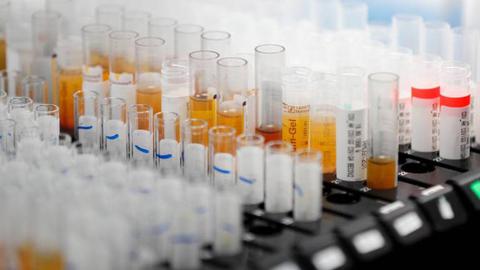 Foto EPA/RONALD WITTEK