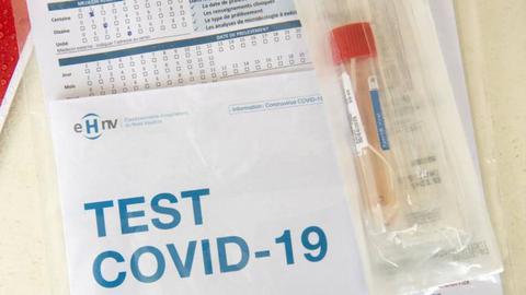 Foto EPA/LAURENT GILLIERON