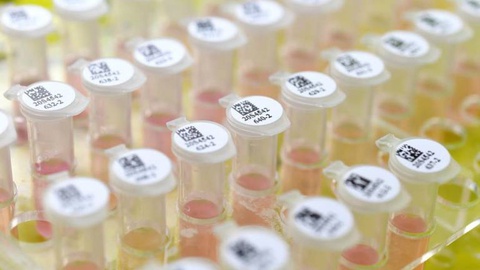 Foto EPA/SHEPHERD ZHOU