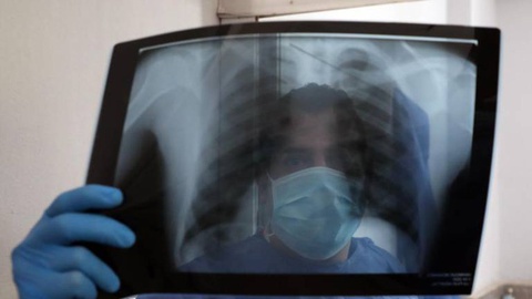 Foto EPA/KHALED ELFIQI