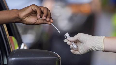 Foto EPA/ERIK S. LESSER