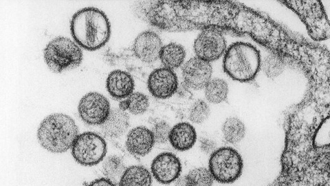 Esta estirpe é responsável por uma síndrome invasiva infecciosa, caracterizada por abcessos hepáticos com manifestações extra-hepáticas.