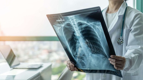 None