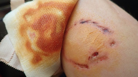 Foto ilustrativa/Shutterstock